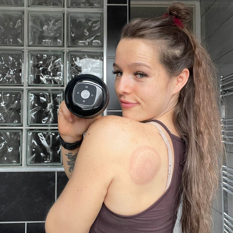 Natürliche Behandlung | Schröpfen ist eine natürliche Therapieform, die keine Medikamente oder Chemikalien verwendet.