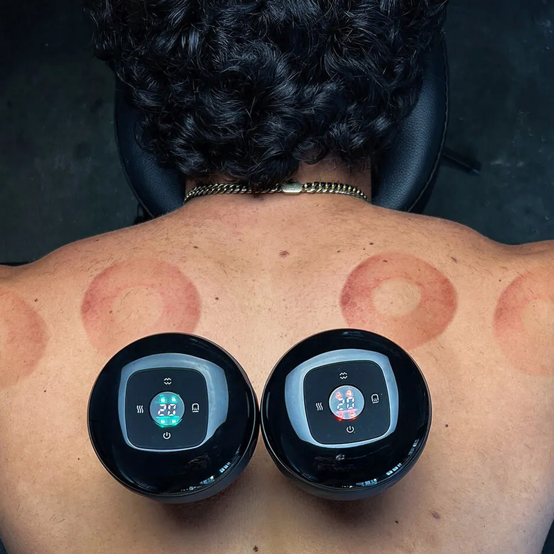 Alte Heilmethode neu entdeckt | Athleten und Stars nutzen die Schröpftherapie - für eine ultimative Erholung und Spitzenleistung.